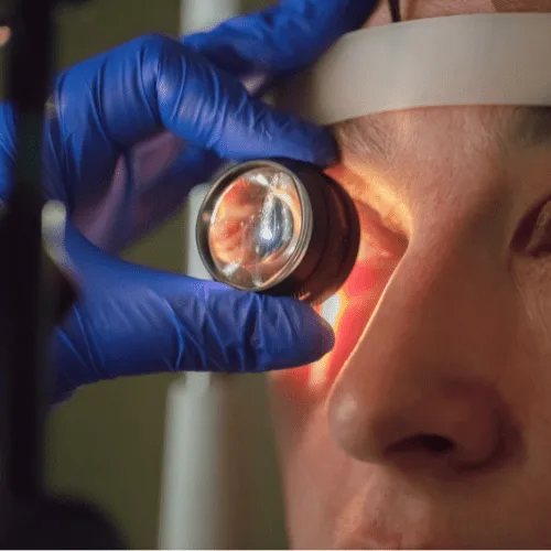 ¿Qué especialista trata la queratitis en CDMX?